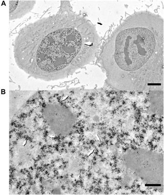 Fiber-Like Organization as a Basic Principle for Euchromatin Higher-Order Structure